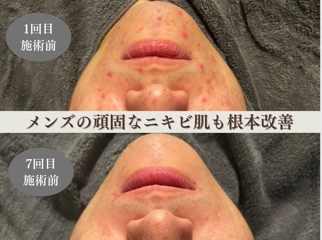 サロンのこだわり②マッサージオイル：純度100%精油＋キャリアオイル